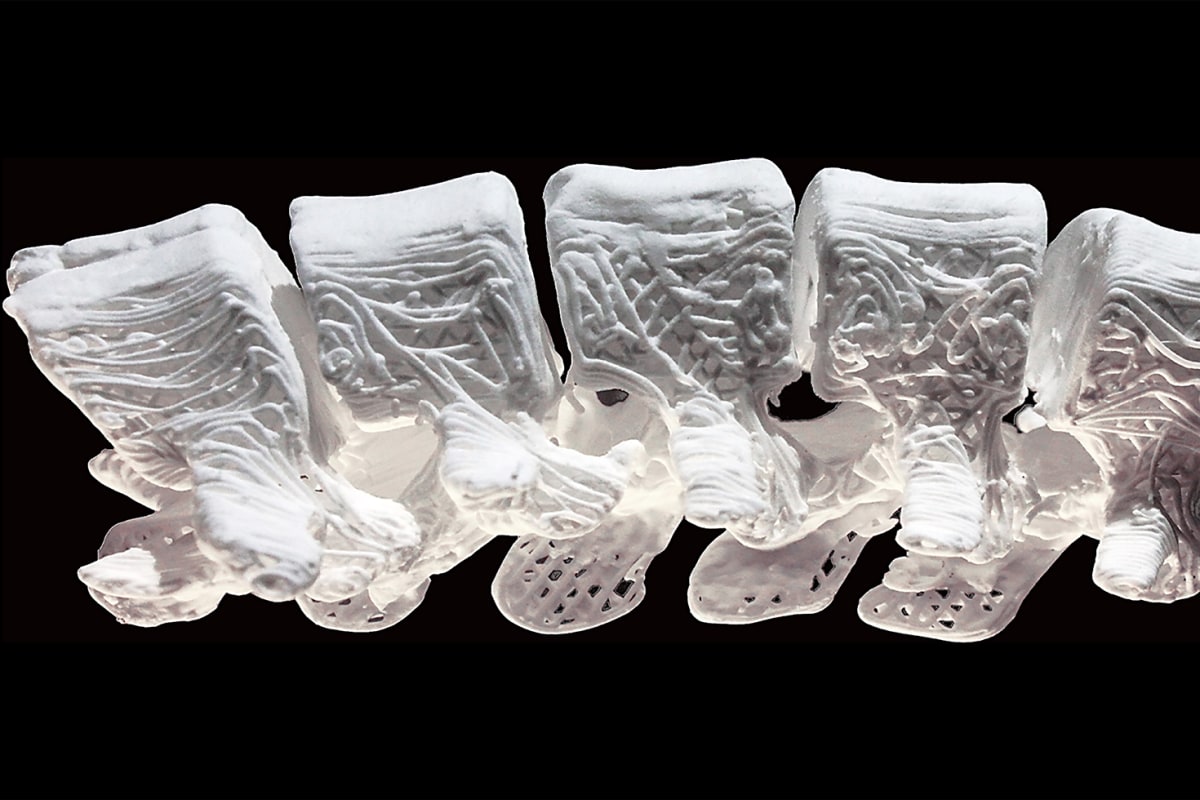 Researchers Make 3-D Printed 'Bone' for Implants