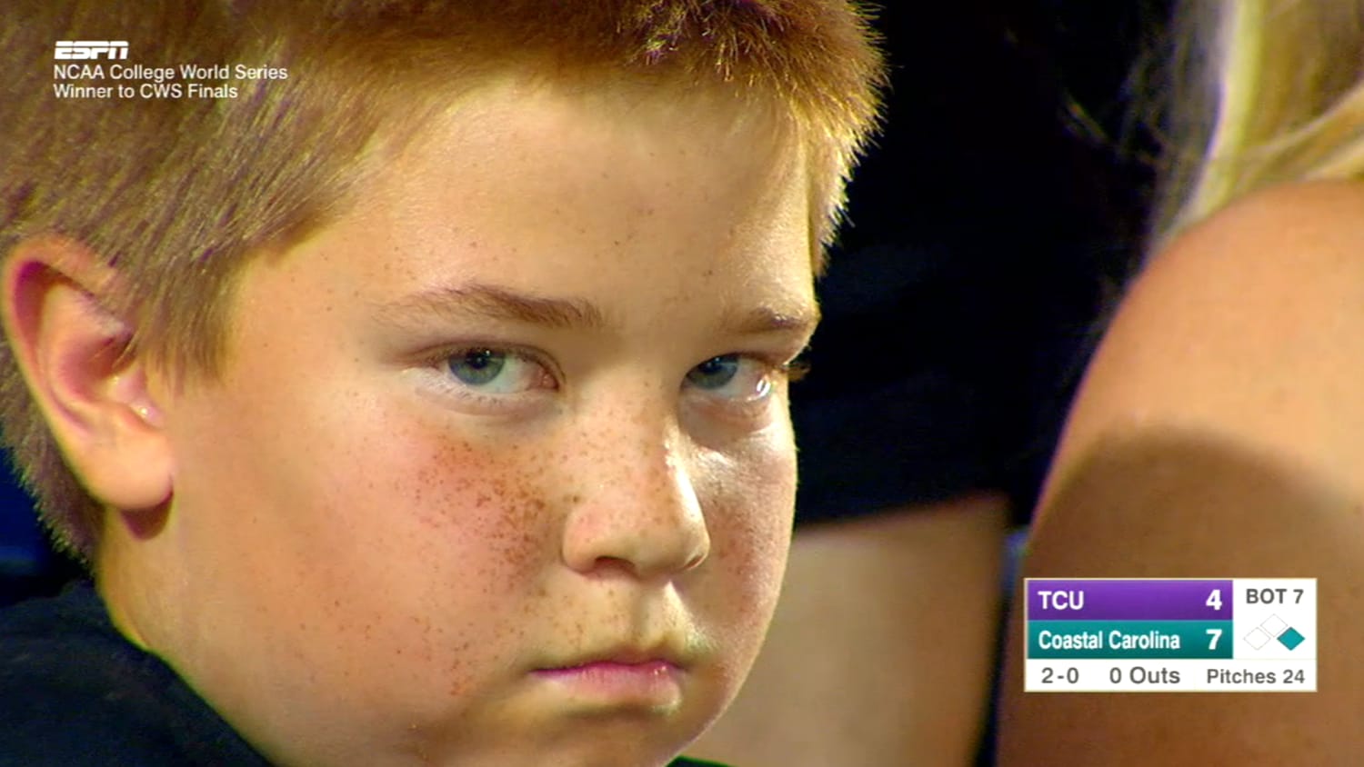Kid's epic death stare steals the show at baseball game - TODAY.com