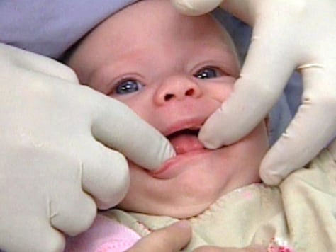 Image: Baby at dentist