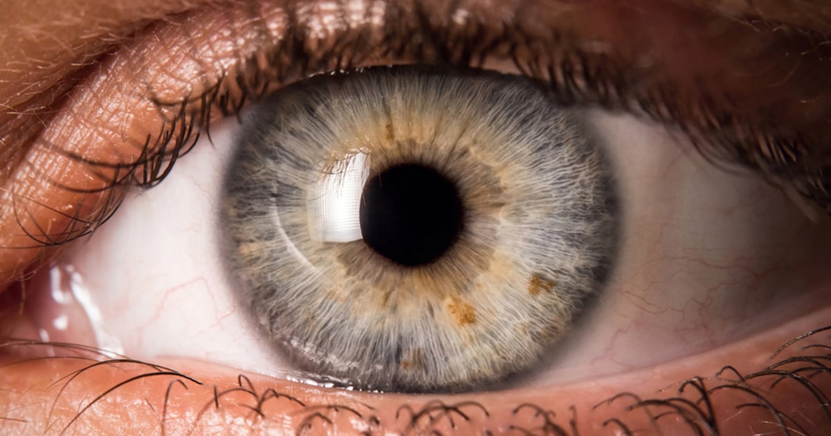 What are eye floaters? 5 vision symptoms you shouldn't ignore