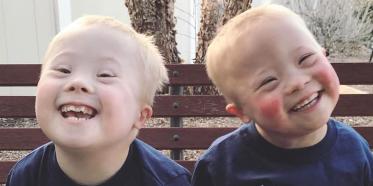 case study of a 3 year old with down syndrome