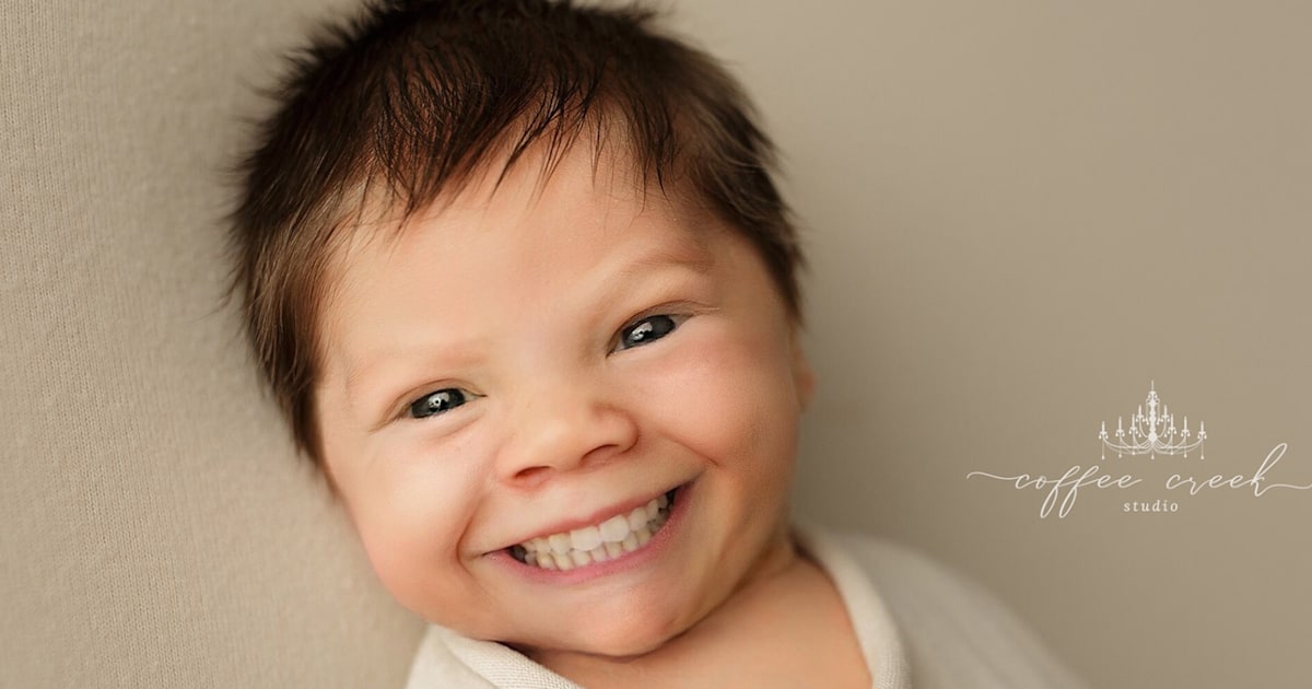 Viral FaceApp photos show newborns with teeth