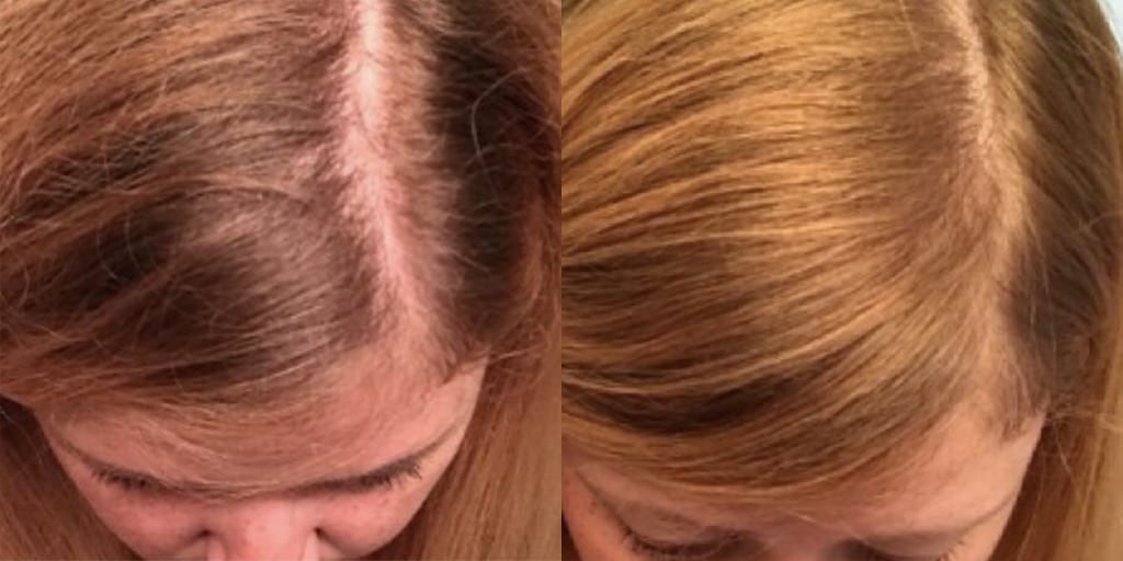 People Are Loving This Affordable Hair Lightening Spray