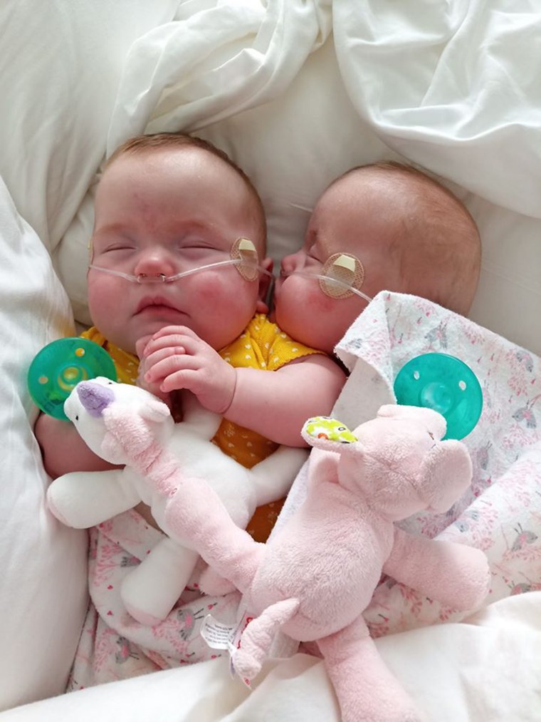 Mikropreemie-Zwillingsmädchen Everlei und Rylei