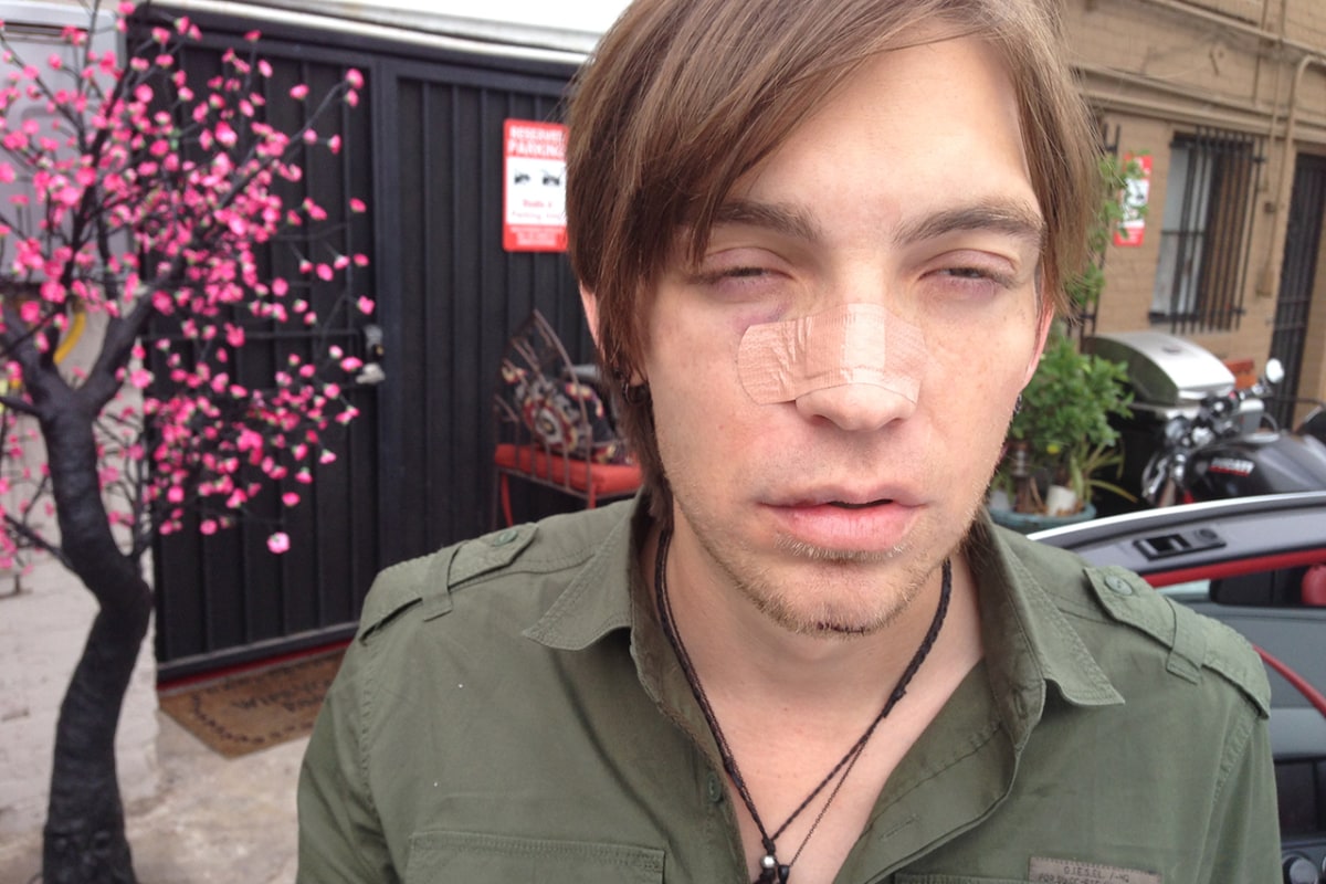 The Calling singer Alex Band abducted, beaten in Michigan - NBC News